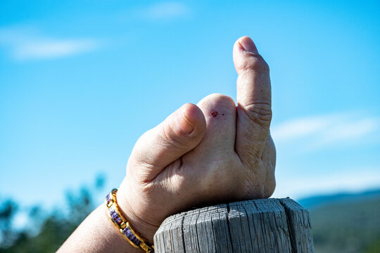 Haciendo un peineta, mujer con artrosis.