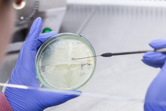 A microbiologist scientist takes a strain of bacteria from a petri dish with a microbiological loop.