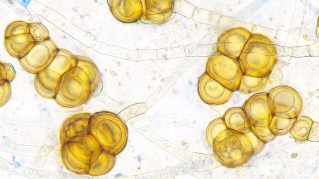 Chlamydospores of Gliocephalotrichum bulbilium in PDA agar. The fungus was isolated from a rotten rose apple in Indonesia. Stained using lactophenol cotton blue. Stacked from 19 images.