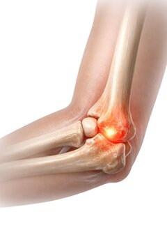 Anatomical illustration of an elbow joint with inflammation highlighted in red