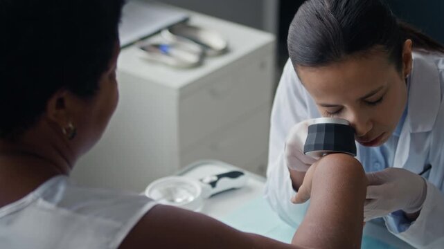 Over shoulder shot of female dermatologist performing hand and finger skin cancer screening using dermatoscope during medical examination in dermatology clinic