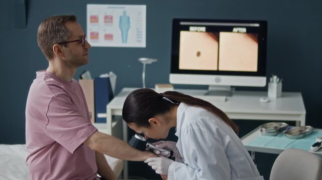Female dermatologist performing skin cancer screening using dermatoscope on male patient arm in modern clinic with mole image on desktop computer monitor in background, side view medium shot