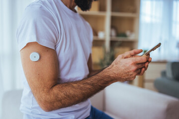 Man With Continuous Glucose Monitor On Arm Using Smartphone At Home For Diabetes Management And...