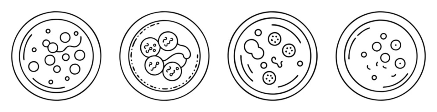 Four distinct Petri dishes showing cell cultures with varying growth patterns
