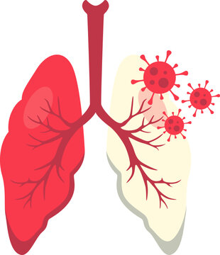 World tuberculosis day illustration. Lung infection, lung health, tuberculosis awareness. Vector isolated.