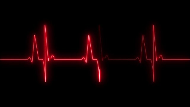 Red ECG Heartbeat Monitor Seamless Loop Animation on Black Background for Hospital and Medical Use