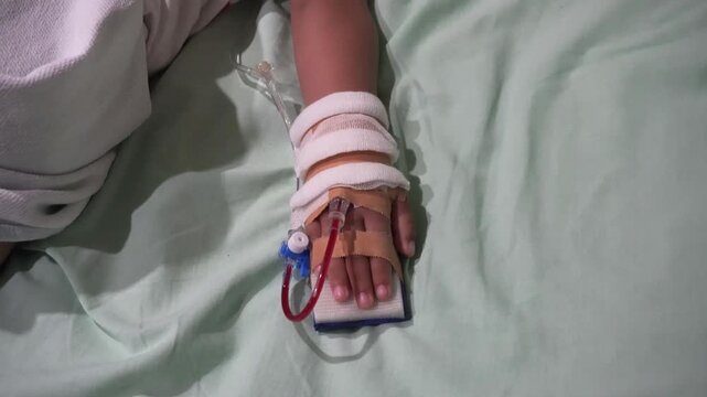 Toddler's hand on IV drip. Blood is visible on the tube. Children with hand fever patients must be given an IV line in the hospital. Concept of leukemia coma due to Cancer, Pediatrics, Dengue fever. 