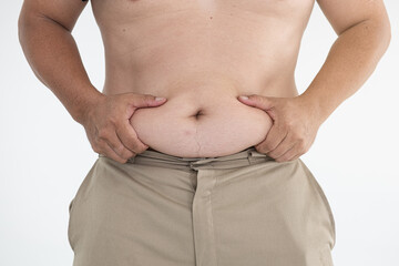 Naklejka premium Overweight male torso pinching belly fat with hands, visible stretch marks and casual trousers, body confidence and health awareness