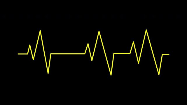 Heartbeat flatline ecg tracing on black background suitable for medical, healthcare, cardiology concepts. Great for articles, presentations, social media, and web.