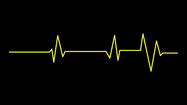 Heartbeat flatline line on dark background for medical concepts, health campaigns, wellness websites, and graphic design projects. Perfect for healthrelated visuals.