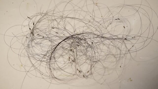 Close Up Hair Lice Colony On Fallen Hair After Combing - Head Lice Infestation Crawling On Hair Strands Macro Footage