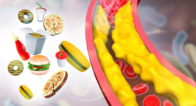 A medical concept illustration of a human blood vessel being clogged by greasy junk food like hamburgers and fries, representing the risk of high cholesterol and arterial blockage. 3d illustration