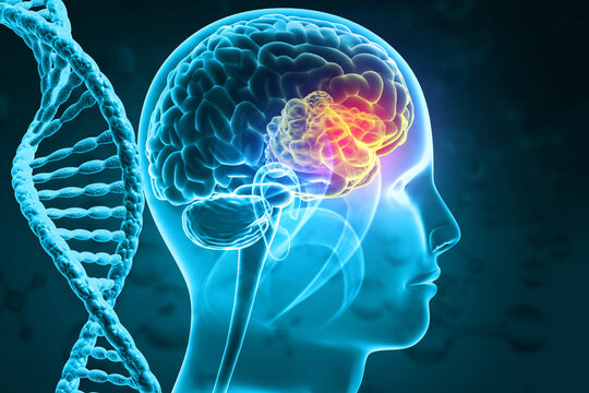 Anatomical 3D model of a human brain showing a localized tumor growth alongside a glowing double-helix DNA strand to represent genetic mutation.