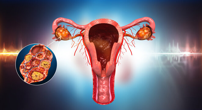 Detailed 3D anatomical model of the human uterus, fallopian tubes, and ovaries presented on a professional abstract medical background.