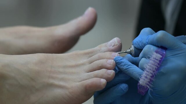 Foot care treatment in progress with pedicure tools and gloved hands visible