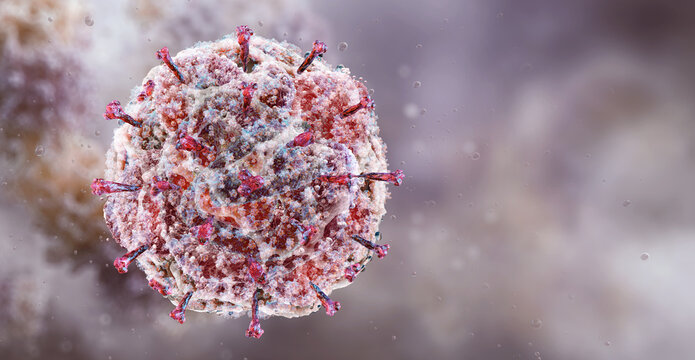 Respiratory Syncytial Virus (RSV) virion with protruding glycoprotein spikes representing viral airway infection in respiratory tract. A causative agent of bronchiolitis and viral pneumonia disease