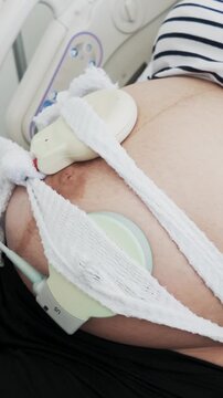 Pregnant woman receiving cardiotocography test in hospital