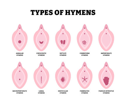 Different types of hymen shape types. Labeled annular, crescentic, septate, cribriform, imperforate, microperforate, labial, denticular, fimbriated, parous introitus. Maidenhead vector illustration.