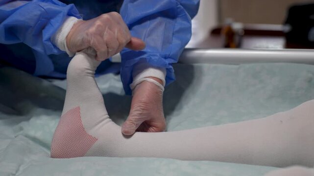 Doctor Examining Patient Foot After Brace Removal. Medical professional examining a patient foot and ankle, which is covered in a white compression stocking, following the removal of a stabilizer