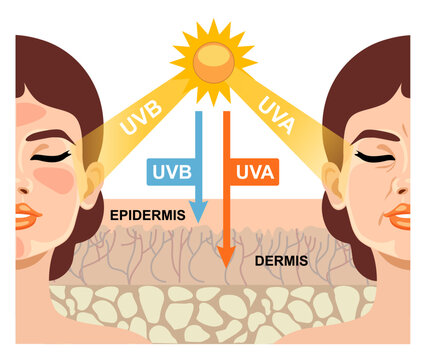 Sun damage to skin.The difference of radiation 2 types in sunlight which is harmful to the skin. Infographic of difference between UVA and UVB rays. UV penetration into human skin and woman face