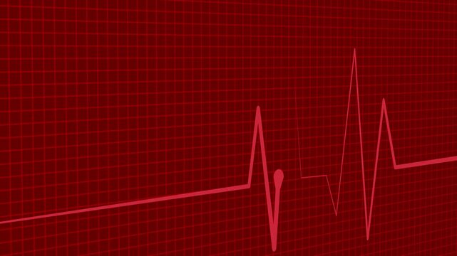 Electrocardiogram heartbeat wave signal animation on grid background