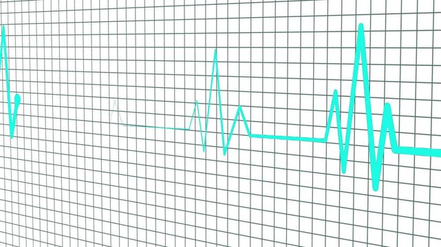 Ecg heartbeat line on grid background animation