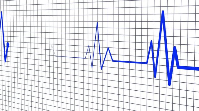 Ecg heartbeat line on grid background animation