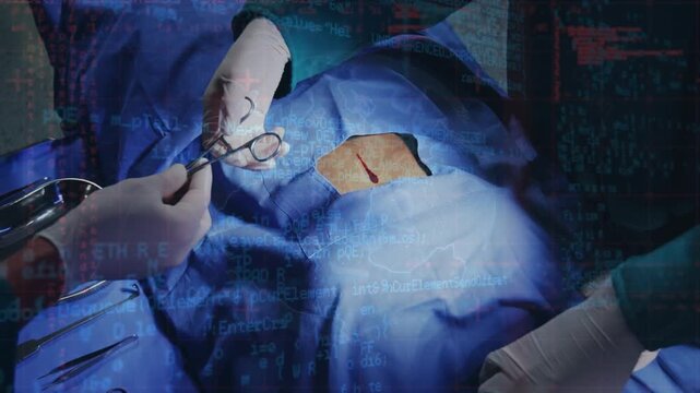 Animation of data processing over surgeons during surgery
