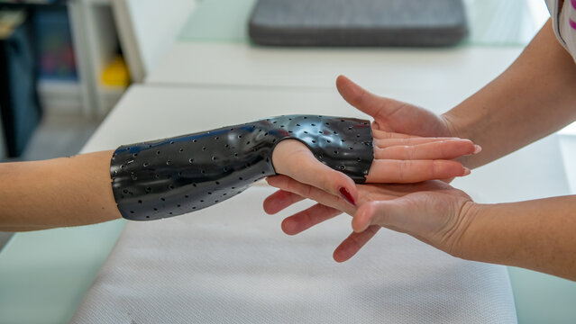 Hand splint application by a professional therapist in a modern physiotherapy center