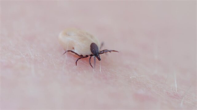 A castor bean tick (Ixodes ricinus) crawls on human skin. The parasite attaches to the skin to feed on blood. Ticks can transmit borrelia bacteria and cause infection. The image shows the health risk.