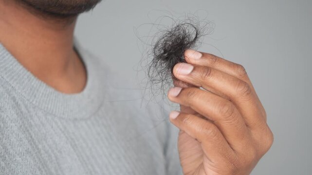 Close up video of a man holding a clump of black hair in his hand, illustrating hair loss and concerns about male pattern baldness, motion footage