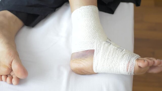 Injured ankle with bruising wrapped in white medical bandage and medical clips