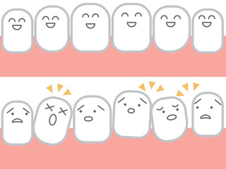 悪い歯並びから綺麗な歯並びへ歯並びの改善 歯科イメージ セット