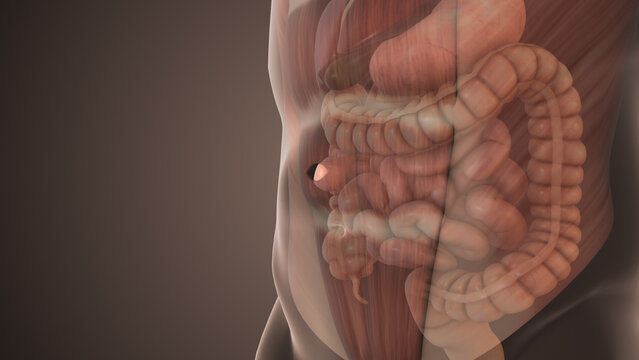 Epigastric Hernia Bulge in Abdominal Wall