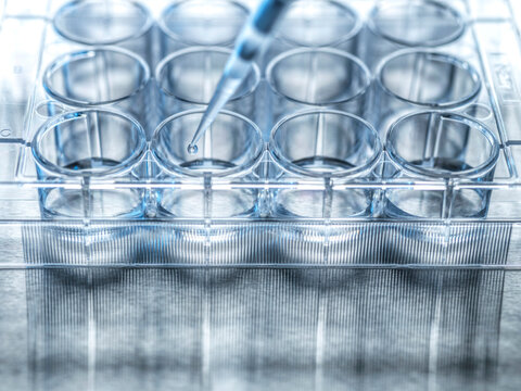 Medical sample being pipetted into microplate