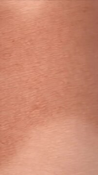 Realistic Macro Skin Texture With Post Inflammatory Hyperpigmentation Showing Epidermal Layer Detail Illuminated with Soft Light Against a Neutral Background