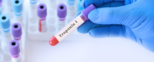 Doctor holding blood sample tube with troponin test in medical laboratory, cardiac diagnostics and...