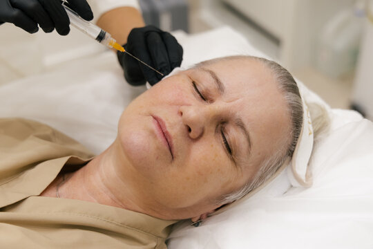 Facial Injection Procedure for Mature Skin Rejuvenation