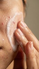 Naklejka premium Close up person applying white cleansing foam to face with acne. Focuses on skincare routine for sensitive skin. Ideal for beauty blogs, dermatology articles, or cosmetic product ads.