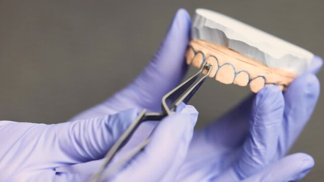 Close up of orthodontic bracket positioned on upper jaw plaster model using reverse tweezers emphasizing precise placement ligature procedure and professional dental workflow for braces treatment