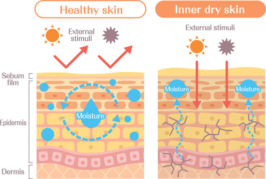 Inner dry skin structure diagram comparison