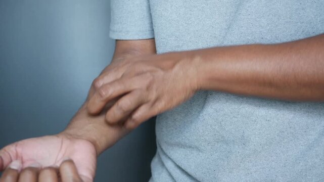 Uncomfortable skin irritation on arm close up, man scratching dry skin on forearm, motion video footage