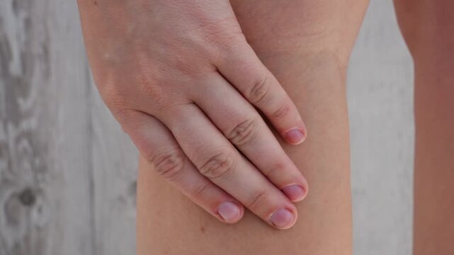 Unrecognizable woman with bruise on her leg. Close up of stain bruise wound on leg. Healing injury hematoma blood consequences of sport activity trauma. Extravasation blue purple yellow on skin 