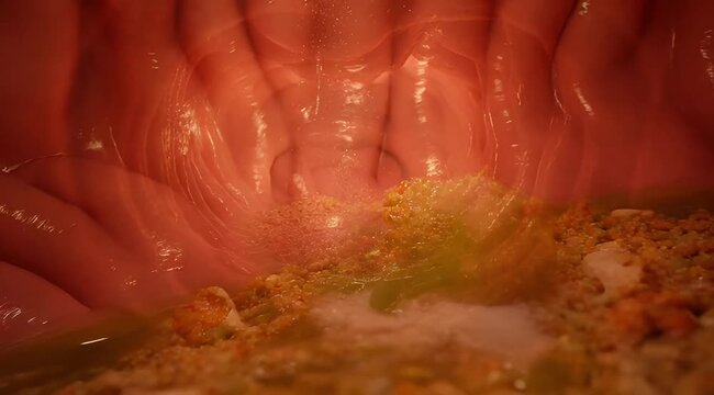 Endoscopic closeup view of internal tissue inside a hollow organ showing mucosa.