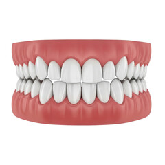 Obraz premium A set of white teeth with red gums in a dental model