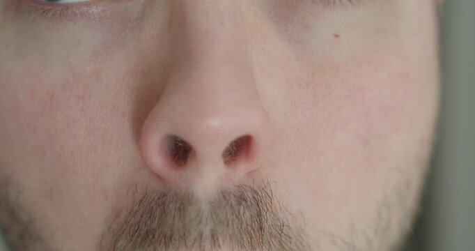 Close-up of a man scrunching and touching his nose due to dryness and itching. Concept of nasal irritation, allergy, cold symptoms and personal discomfort.