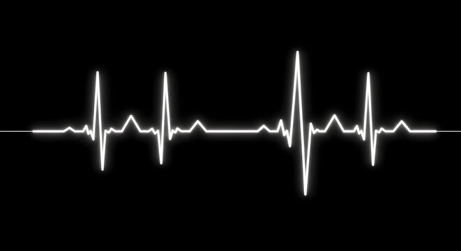Electrocardiogram pattern on black background