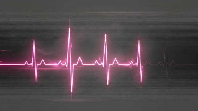 Pink Neon EKG Heartbeat Line Pulse on Dark Screen