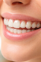 Obraz premium Close-up of a beautiful smile with clear aligners visible
