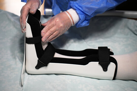 Medical Professional Adjusting Ankle Orthosis Brace. Doctor carefully correcting the fit of a orthopedic ankle foot orthosis (AFO) for a patient in a hospital bed. Focused on clinical rehabilitation
